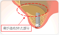 歯周病のリスクを高める3つの要因！